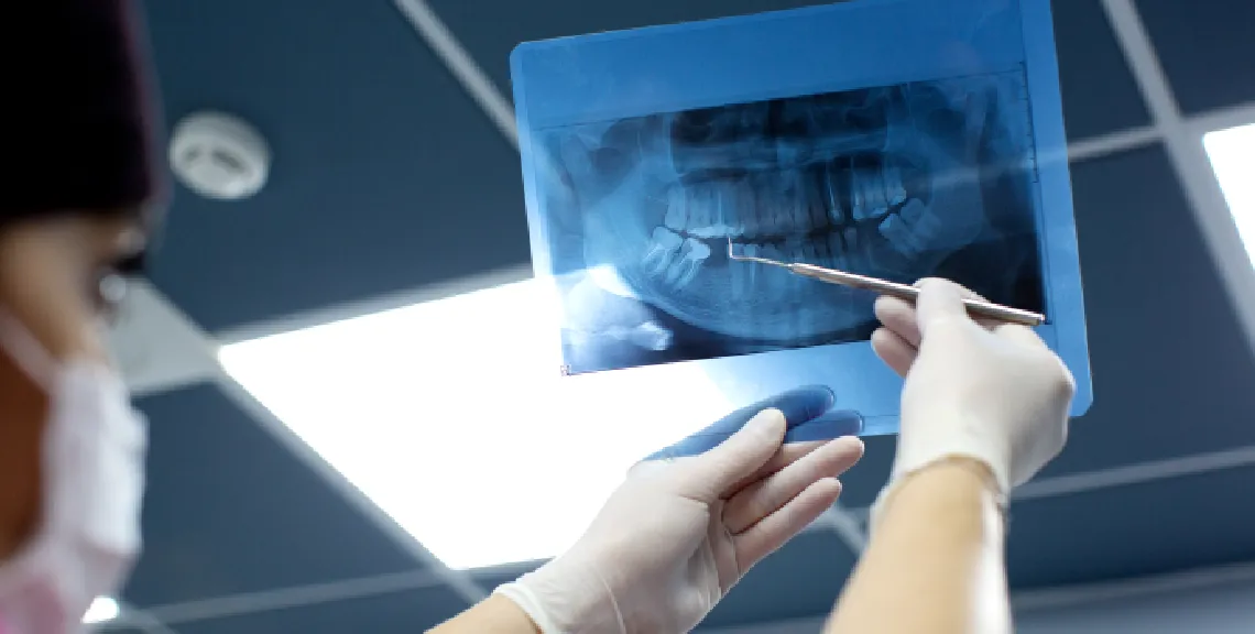 estudio-perdida-dental-indicio-mortalidad-adultos-mayores