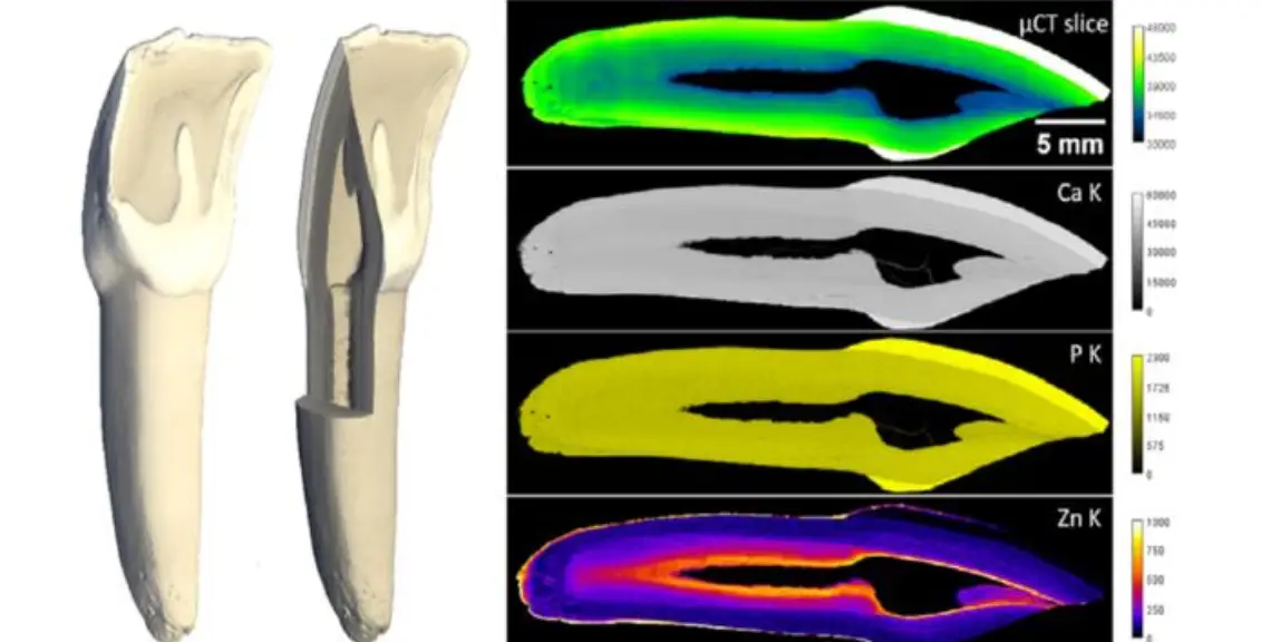 Estudio zinc en los dientes