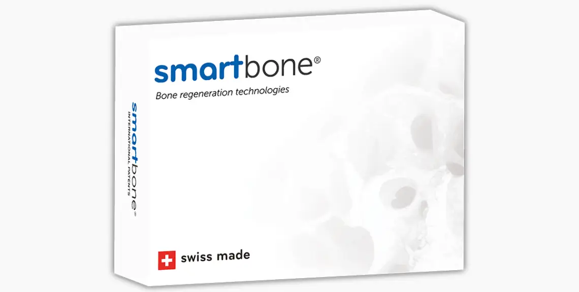 SmartBone, de Surgydental