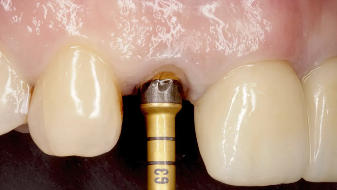 Durante el congreso se presentó la nueva Junta de SELO, presidida por el Dr. David Abad.