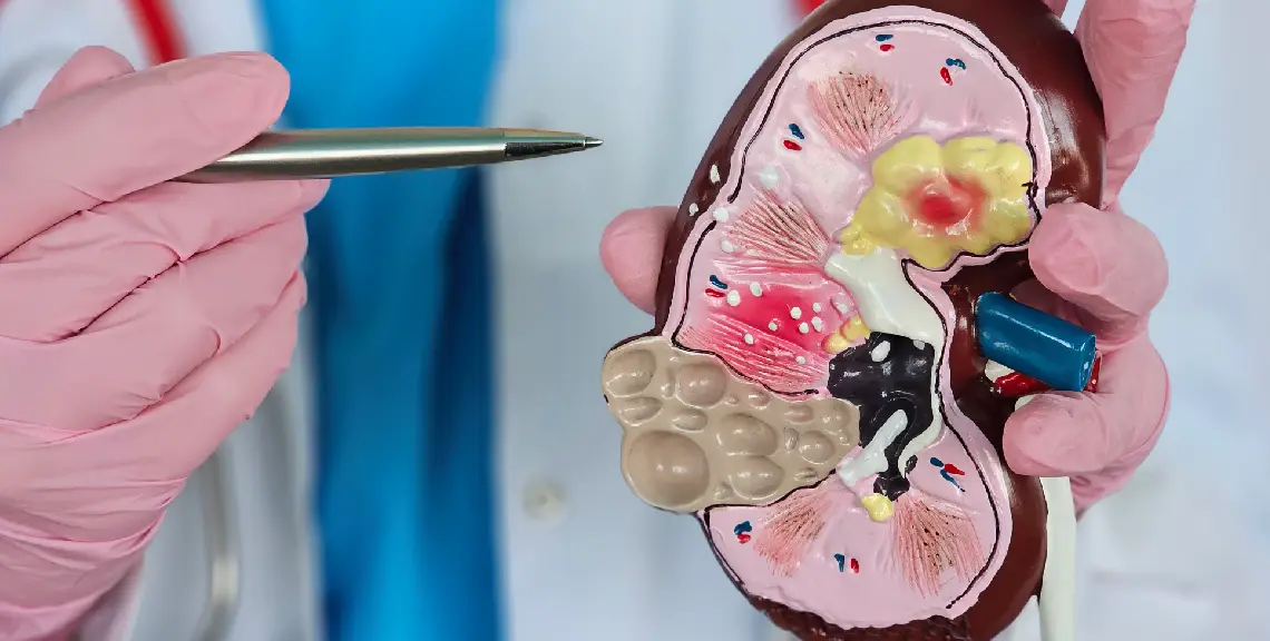 enfermedad renal crónica y relación con enfermedad periodontal