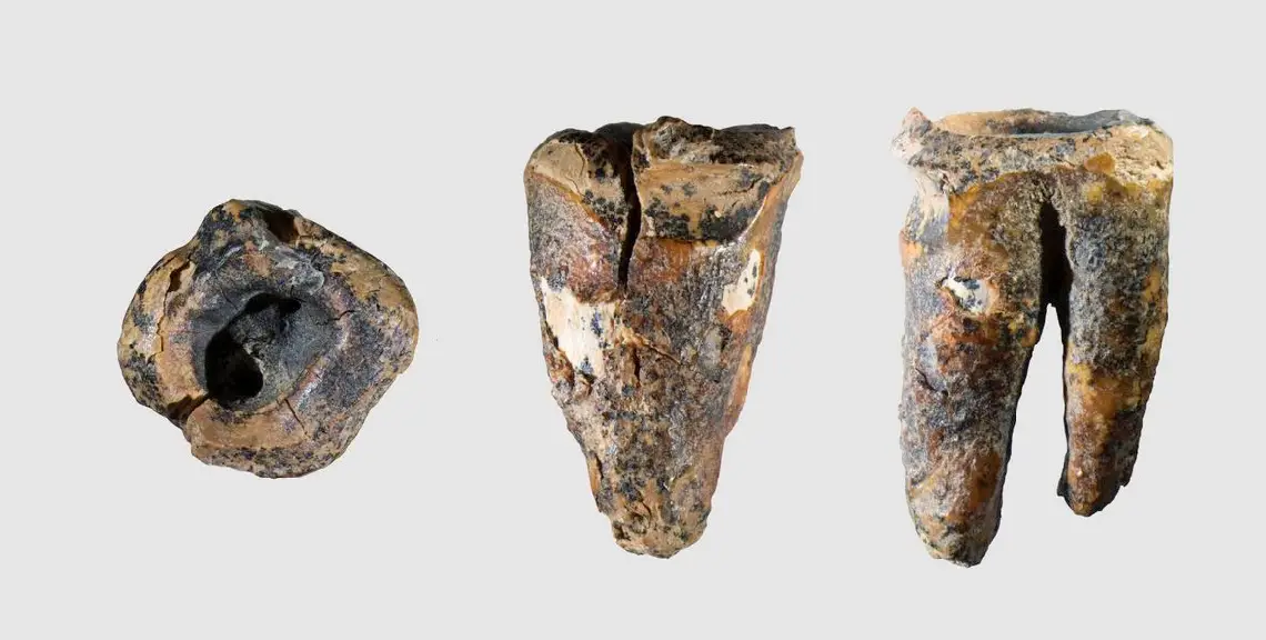 Odontología neandertales