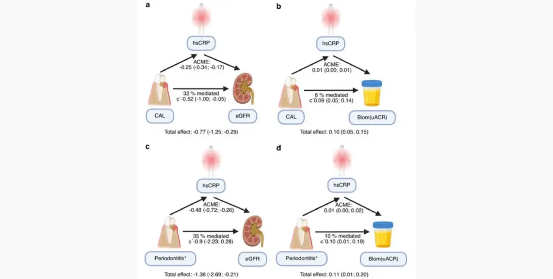 periodontitis enfermedad renal