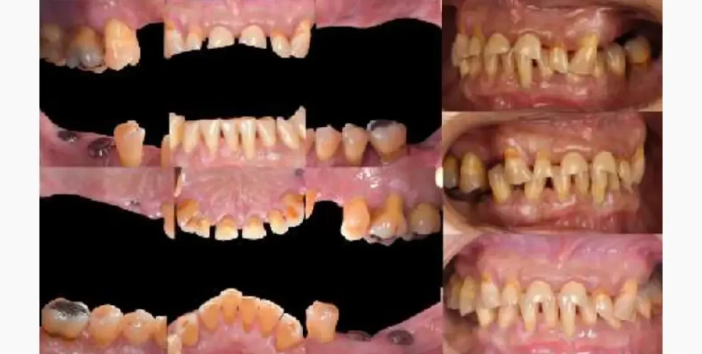 Tomasso Premio Sanitas Dental Star 2025