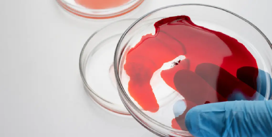 pacientes con hemofilia en clínica dental