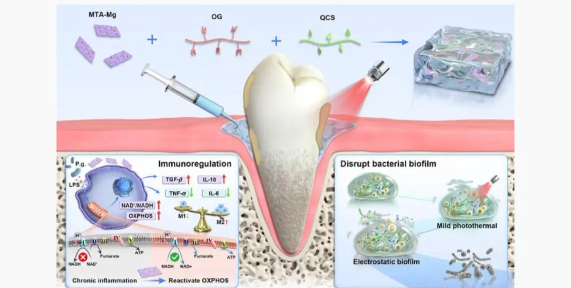 hidrogel para periodontitis