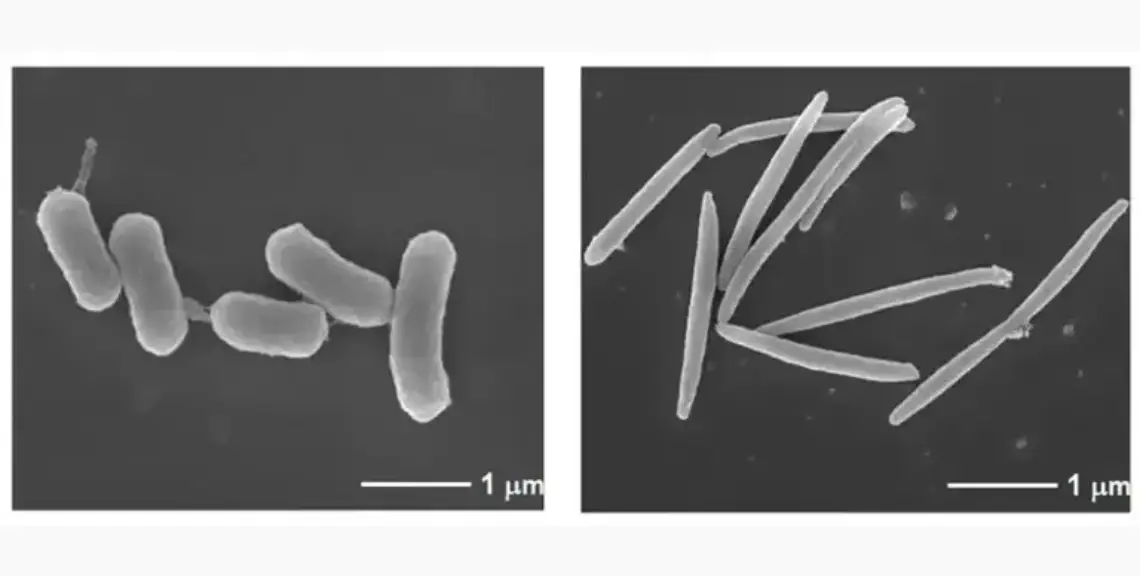 MDPI Las bacterias P. gingivalis (izquierda) y F. nucleatum (derecha) vistas al microscopio electrónico. Imai, Kenichi & Ogata, Yorimasa. (2020). How Does Epstein–Barr Virus Contribute to Chronic Periodontitis?. International Journal of Molecular Sciences. 21. 1940. 10.3390/ijms21061940.