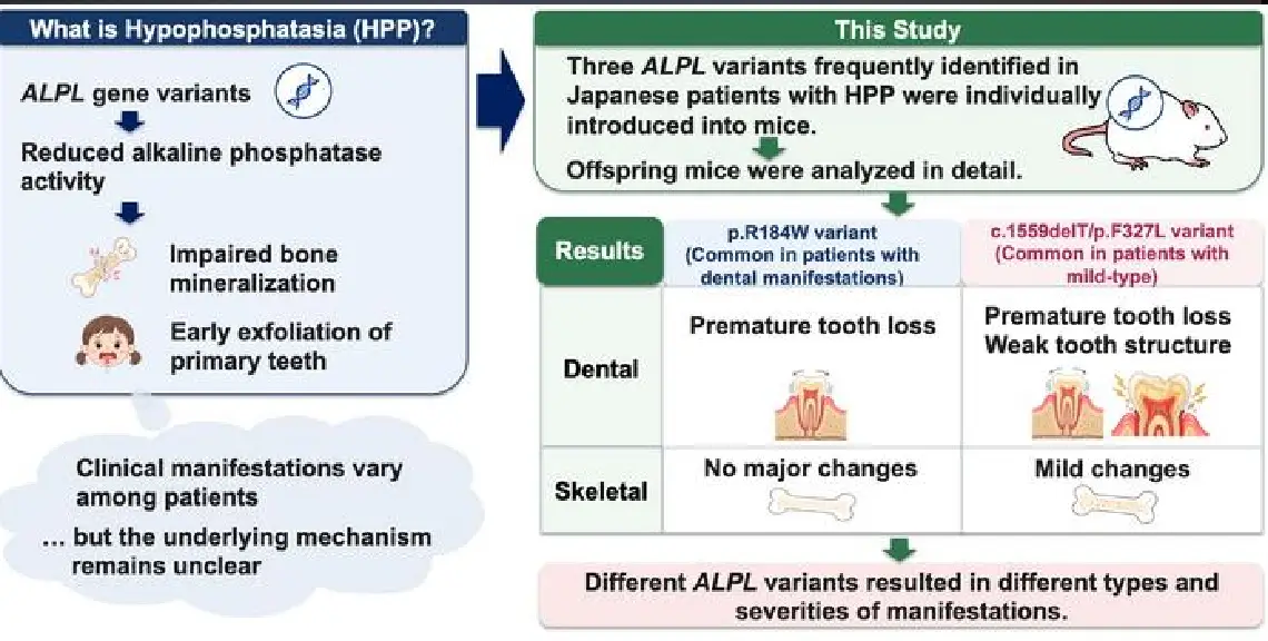 Investigación: hipofosfatasia dental
