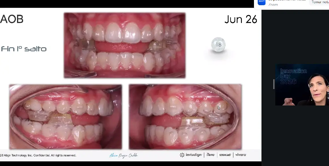 Invisalign Innovation Day