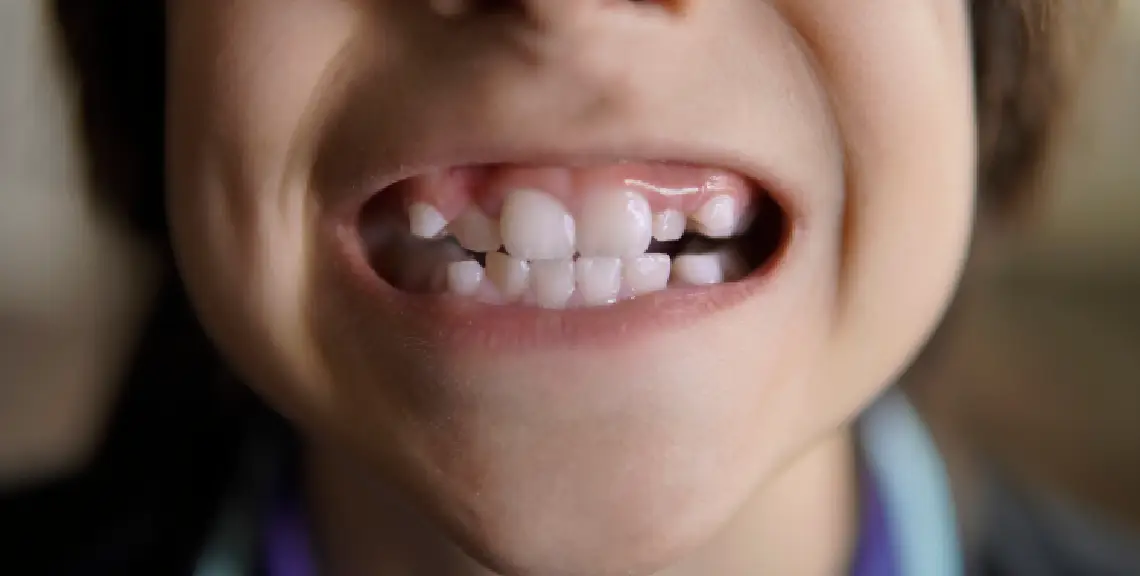 Formación dental en niños