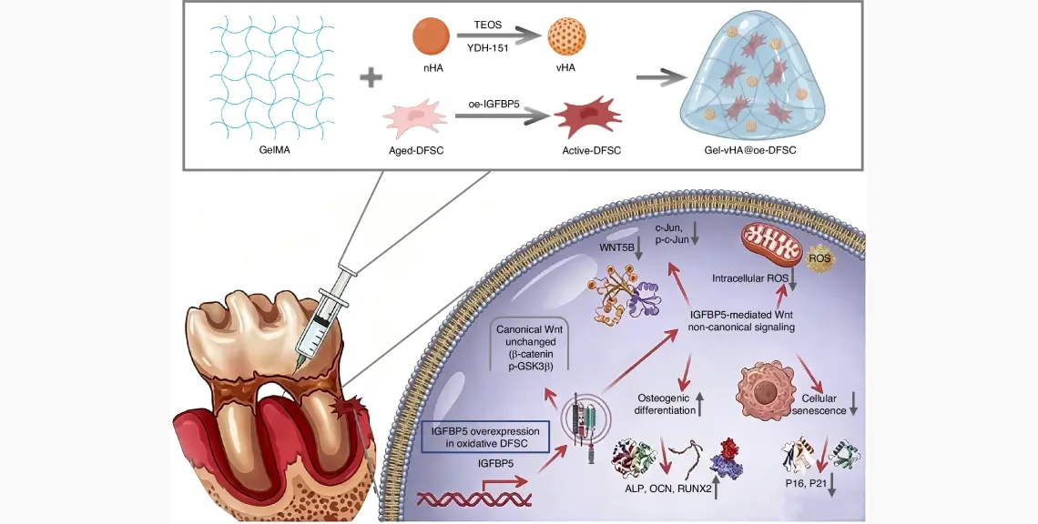 Esquema general de Gel-vHA@oe-DFSC